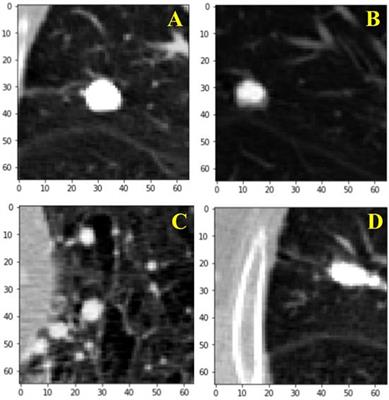 Lung Nodule Detection via Deep Reinforcement Learning